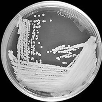 美疾控中心：耳念珠菌目前已遍布美国一半以上的州