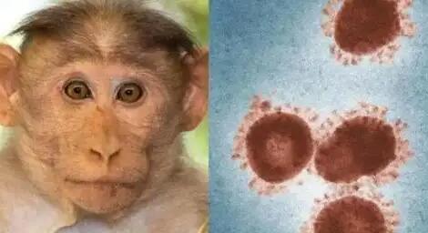 德国出现首例猴痘病例